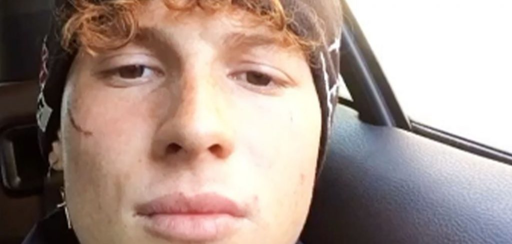 Chi è Wax Amici 22: Età, Instagram, Fratello, Fidanzata e Cicatrice