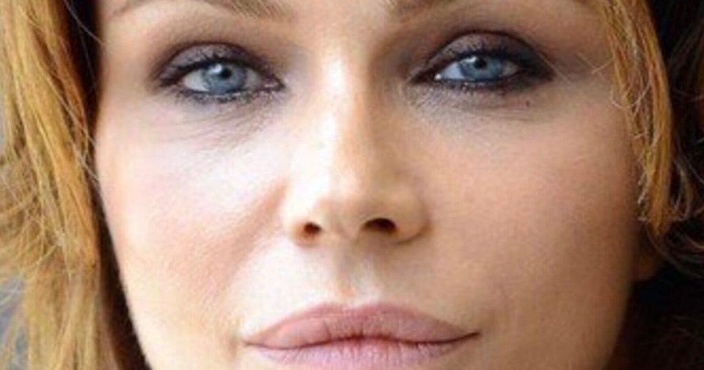 Chi è Francesca Neri e Cos’è la Cistite Interstiziale le ha bloccato la vita